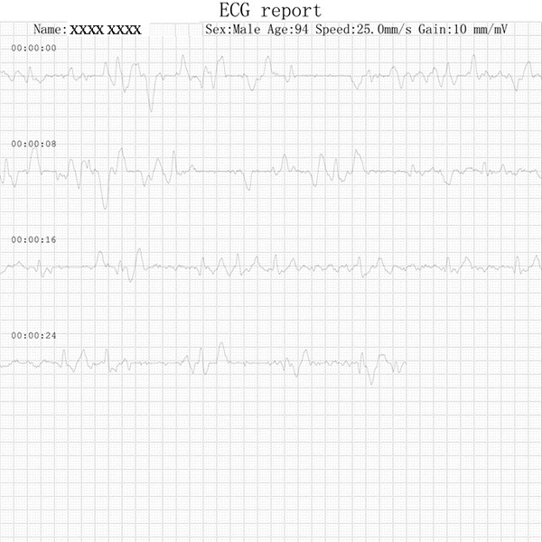 ECG MONOCANALE PALMARE PM10 - a colori - con Software e Bluetooth