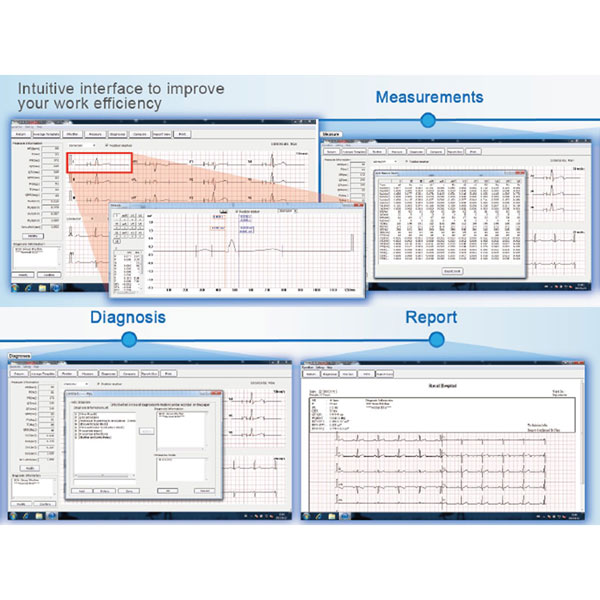 SOFTWARE VISUALIZZAZIONE ECG PER EDAN SMART SE-3C